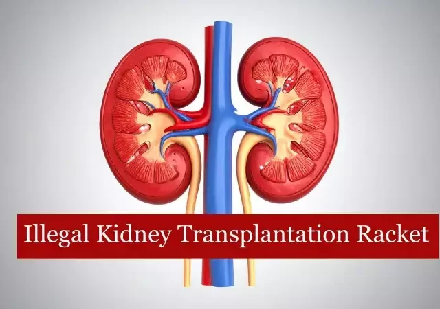 Why illegal kidney transplant rackets keep resurfacing in Delhi