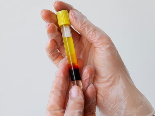 Govt Proposes Dropping Repeat Virus Tests on Plasma-Based Medicines