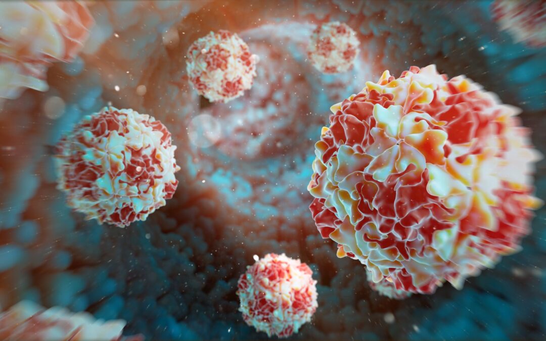 Poliovirus detected in Perth wastewater; officials say risk remains low