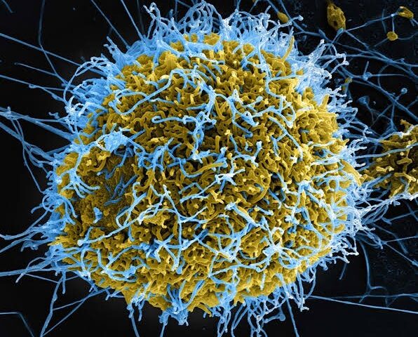 Congo’s Ebola Outbreak Crosses 1,000 Cases; Study Warns of High Risk of Regional Spread