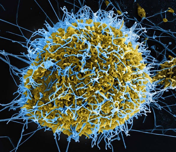 Congo’s Ebola Outbreak Crosses 1,000 Cases; Study Warns of High Risk of Regional Spread