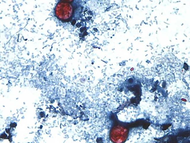 Nearly 1,000 cyclospora cases reported in Michigan in largest-ever parasite outbreak