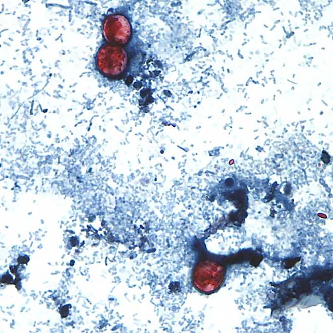 Nearly 1,000 cyclospora cases reported in Michigan in largest-ever parasite outbreak
